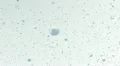 Bubbles in water. HD Footage