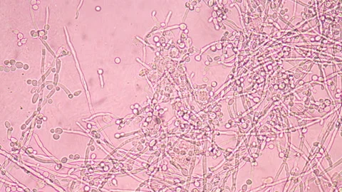 Budding yeast cell in stop motion. Stock Footage 200442576