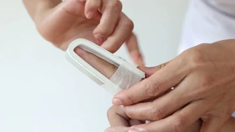 BuddySprint.Application of a splint for broken or dislocated fingers. Stock Footage 147542713