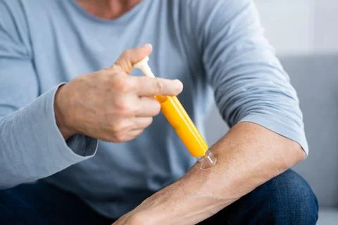 Bug Bite Suction Tool Stock Photos