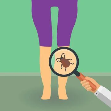 Bug on a leg Stock Illustration