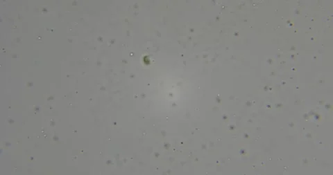 Bulgarian lactic bacteria observed in active motion under microscope revealing Stock Footage 311585113