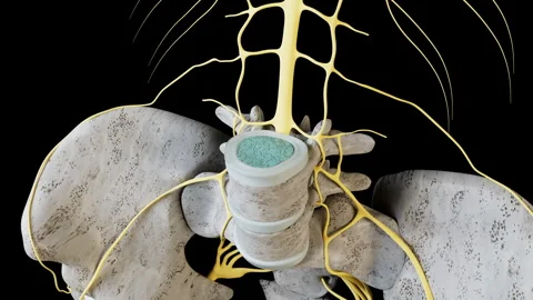 Bulging Disc Overview Video stock 261672745