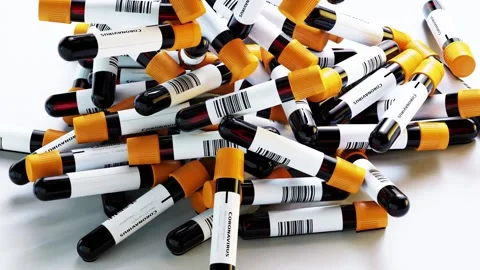 Bulk of blood sample tubes for Covid19 falling on top of each other. Stock Footage 152409558