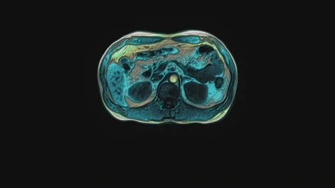 Bulk multicolored CT scan of the abdomen. Computed tomography of the Stock Footage 171522779