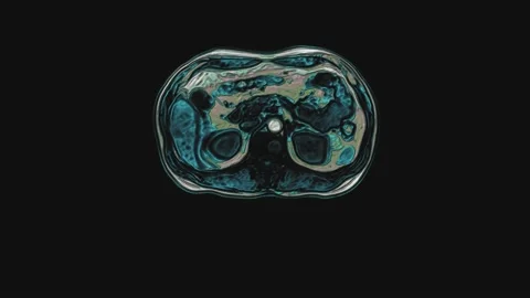 Bulk multicolored CT scan of the abdomen. Computed tomography of the Stock Footage 189887095
