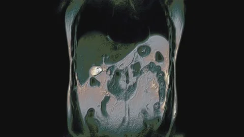 Bulk multicolored CT scan of the abdomen. Computed tomography of the Stock Footage 195628414