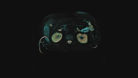 Bulk multicolored CT scan of the abdomen. Computed tomography of the Stock Footage 195628642
