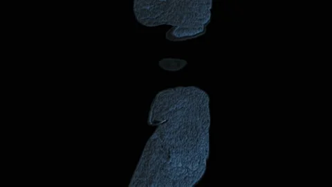 Bulk multicolored MRI of the abdominal cavity, gastrointestinal tract, bladder Stock Footage 137661048