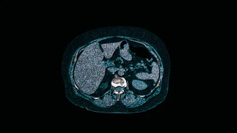 Bulk multicolored MRI of the abdominal cavity, gastrointestinal tract, bladder Stock Footage 138867620