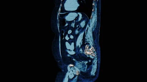 Bulk multicolored MRI of the abdominal cavity, gastrointestinal tract, bladder Stock Footage 138867810