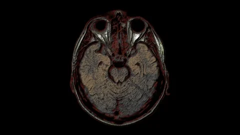 Bulk multicolored MRI scans of the brain and head to detect tumors. Diagnostic Stock-Footage 121518619
