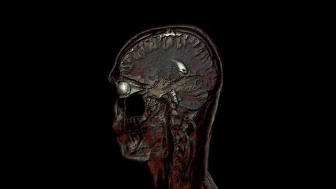 Bulk multicolored MRI scans of the brain and head to detect tumors. Diagnostic Stock-Footage 121804599