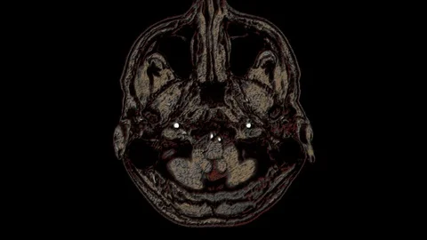 Bulk multicolored MRI scans of the brain and head to detect tumors. Diagnostic Stock-Footage 122073244