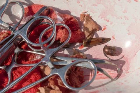 Bullets removed during surgery Stock Photos