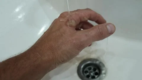 Burn of the hand Video stock 247456447