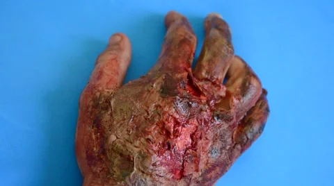 Burned hand moving in blue screen Stock Footage 50667432