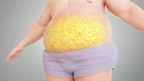 Burning abdominal fat and fat cells in tissue to reduce visceral fat. Stockbeeldmateriaal 344102485