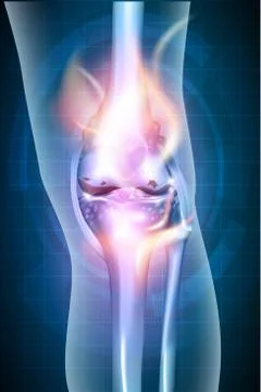 Burning leg knee joint Stock Illustration