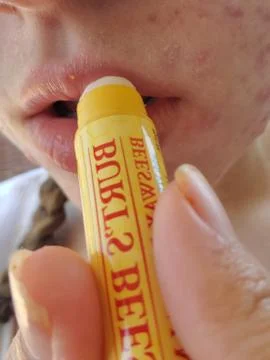 Burt's Bees Chapstick 스톡 사진