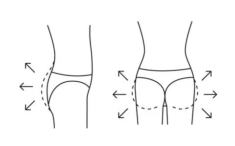 Buttock increase of woman, shape butt with arrow and contour, line icon Stock Illustration