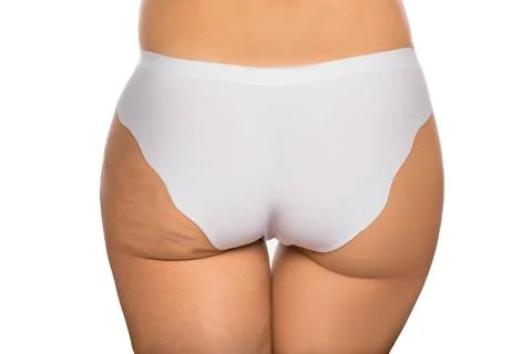 Buttocks with cellulite and without cellulite 写真素材