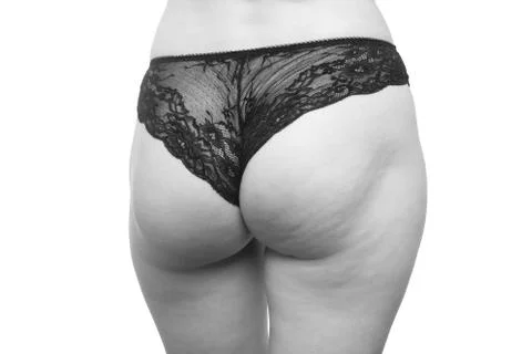 Buttocks with cellulite Photos