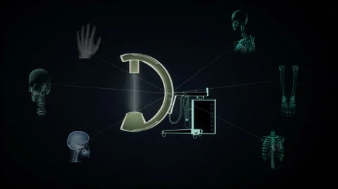 C-Arm X-Ray Machine Scanner, medical diagnosis technology Stock Footage 64229685