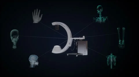 C Arm X-Ray Machine Scanner, medical diagnosis technology. version 2. Stock Footage 64466027