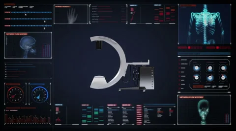 C Arm X-Ray Machine Scanner in digital display dashboard, medical technology. Stock Footage 64840942