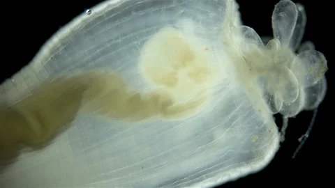 Cactus worm Priapulus caudatus under microscope, phylum Priapulida Stock Footage 248211310