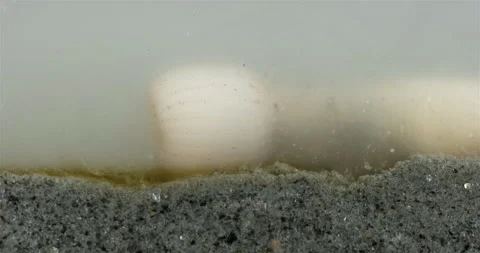 Cactus worm Priapulus caudatus under microscope, Priapulida Stock Footage 288490516