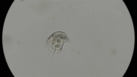 The CAENOMORPHA MEDUSULA microorganism under the microscope Stock Footage 93261271