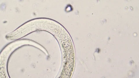 Caenorhabditis and paramecium at microscope Stock Footage 87807941