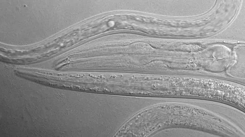 Caenorhabditis elegans Stock Footage 49633920