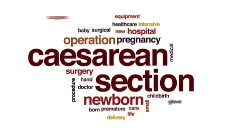 Caesarean section animated word cloud, text design animation. Stock Footage 79586672