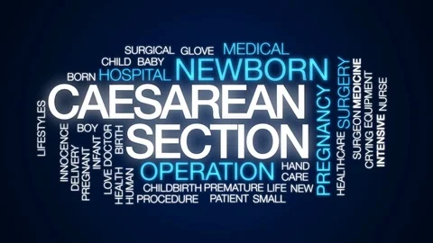 Caesarean Section Stock Videos – Royalty-Free HD & 4K Videos | Pond5