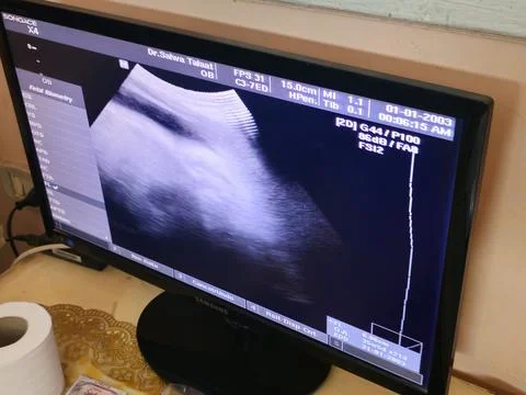 Cairo, Egypt, May 27 2025: Ultrasonography of a pregnant woman showing a he.. Stock Photos