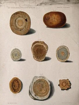 Calculi: eight examples, including uric acid calculi. Chromolithograph afte.. Stock Illustration