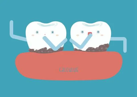 Calculus on teeth make hard Stock Illustration