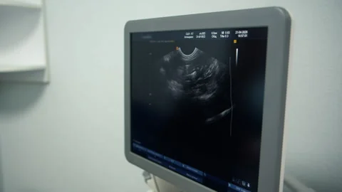 Calm clinical environment featuring diagnostic ultrasound on angled screen Stock Footage 333988402