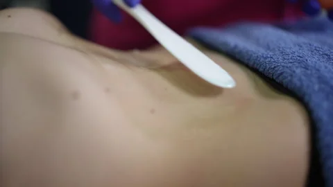 Calming spa environment with expert applying warm wax to chest area Stock Footage 326065216