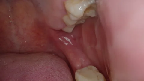 Camera Inside The Mouth Shows Teeth to T... | Stock Video | Pond5