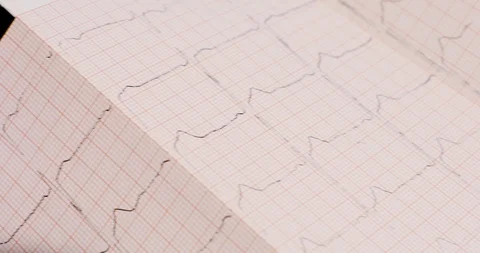 Camera movement from electrocardiogram to empty tablet package Stock Footage 116795338