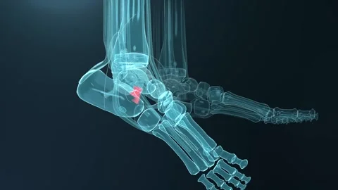 Camera panning showing xray foot bones rotating and zooming in medical render Vídeos de archivo 346154907