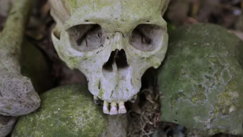 Camera pulls away from a close-up of a human skull. Video stock 217390042