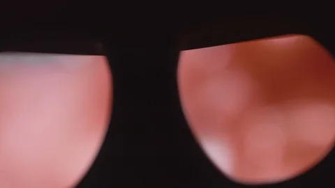 Camera shows patient's internal organs. Robotic operation. Surgeon point of view Stock Footage 89871621