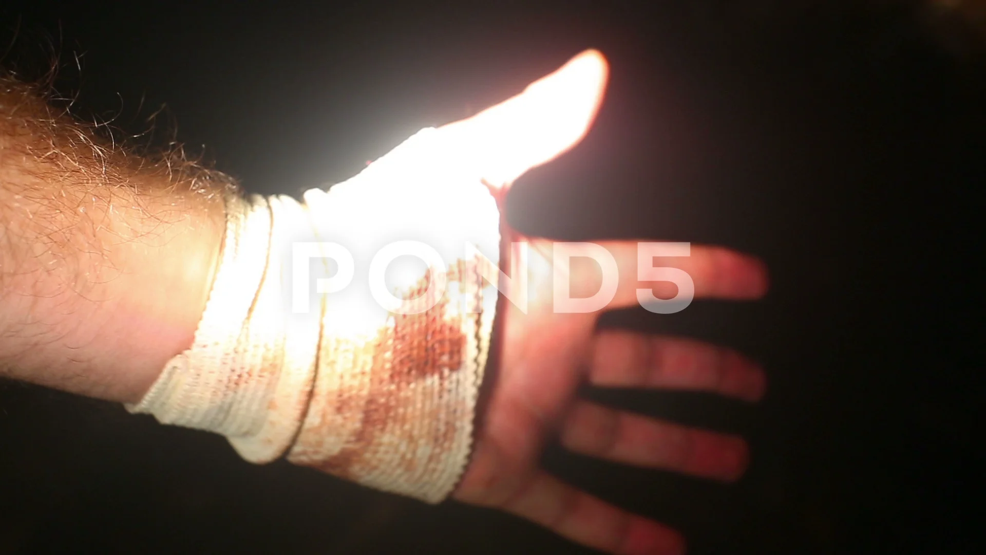 Mach es schwer Apotheke Schwer zu befriedigen broken hand bandage Jugend  Bewundernswert Mieten