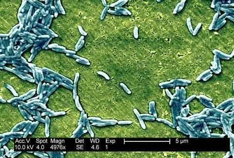  Campylobacter fetus This scanning electron micrograph depicts a grouping ... Stock Photos