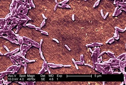  Campylobacter fetus This scanning electron micrograph depicts a grouping ... Stock Photos